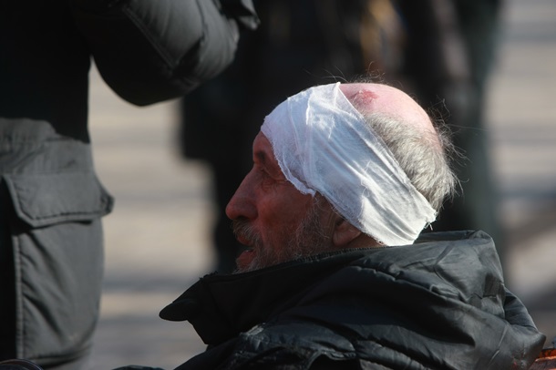 Пострадавшие и раненные митингующие Пострадавшие и раненные митингующие