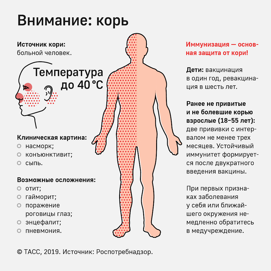Чем отчается ветряная оспа от кори, а скарлатина от краснухи? Корь, скарлатина, краснуха