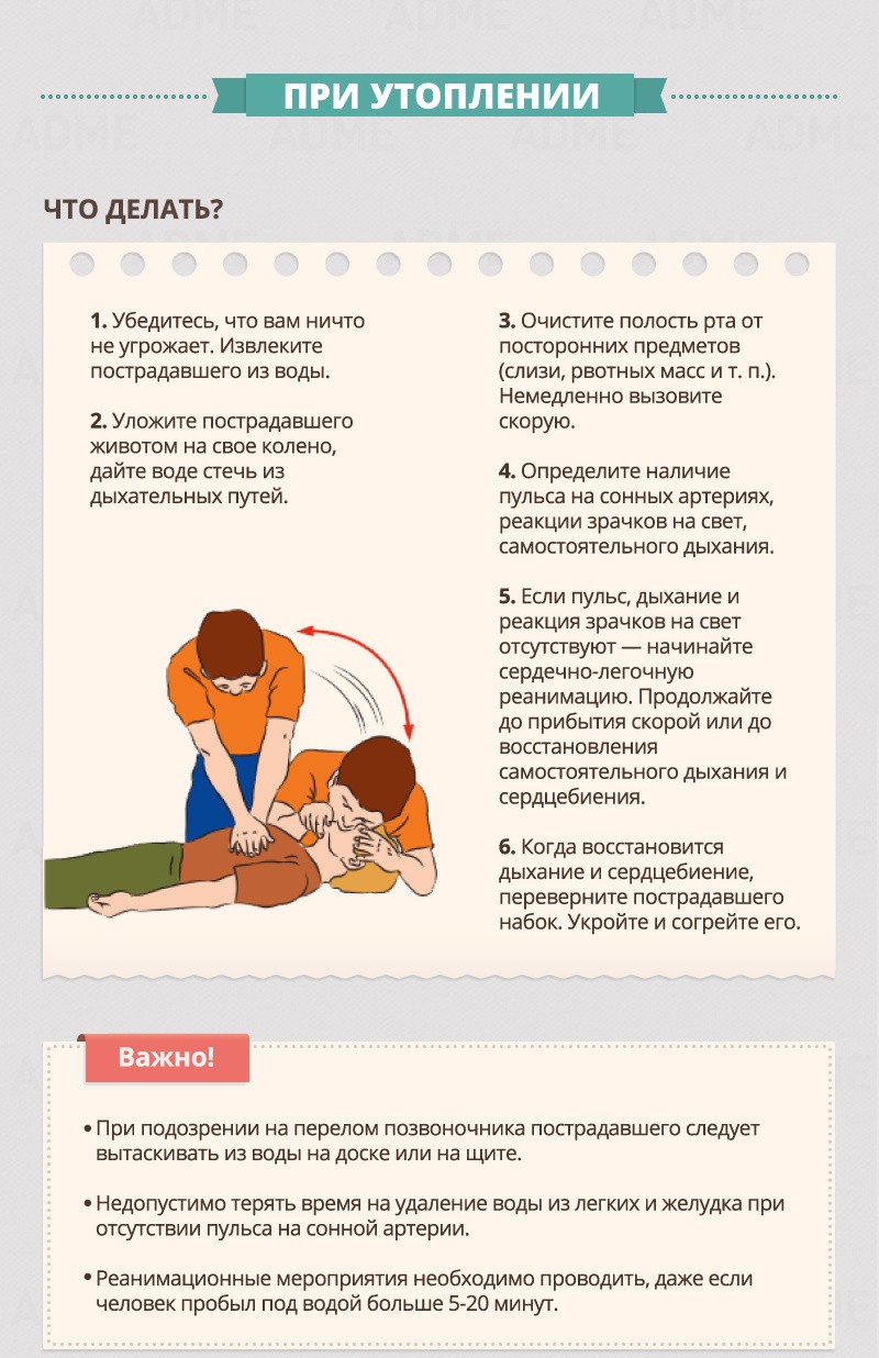 При утоплении - Гид по оказанию первой помощи При утоплении - Гид по оказанию первой помощи