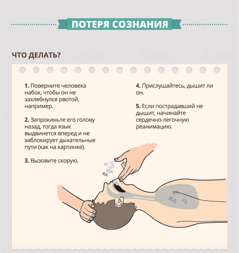 Потеря сознания - Гид по оказанию первой помощи Потеря сознания - Гид по оказанию первой помощи