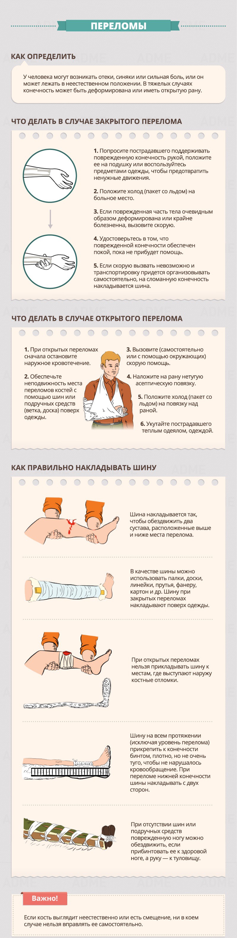 переломы - Гид по оказанию первой помощи переломы - Гид по оказанию первой помощи