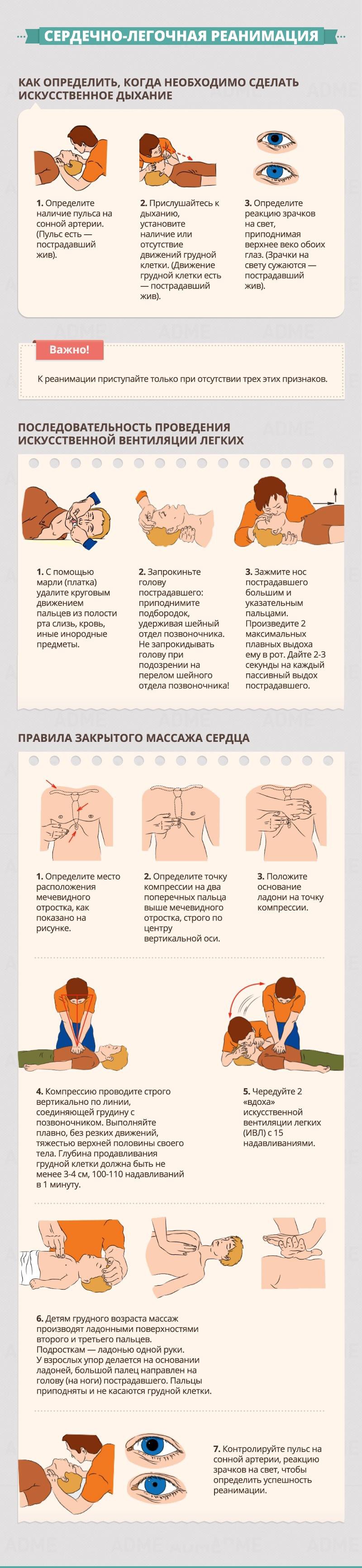 Сердечно-легочная реанимация - Гид по оказанию первой помощи Сердечно-легочная реанимация - Гид по оказанию первой помощи