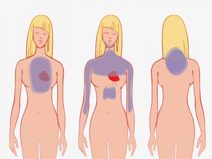 Как распознать сердечный приступ