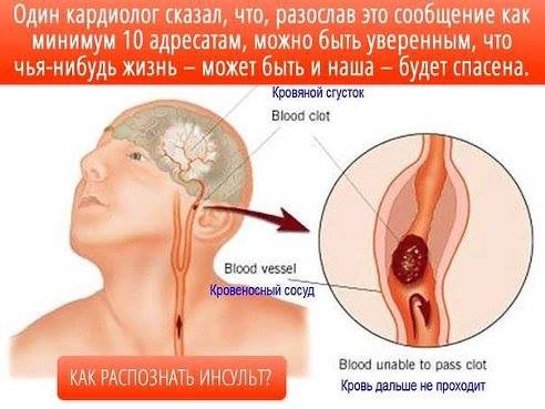 Распознование симптомов инсульта Распознование симптомов инсульта