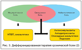 Нейропатические боли Нейропатическая боль