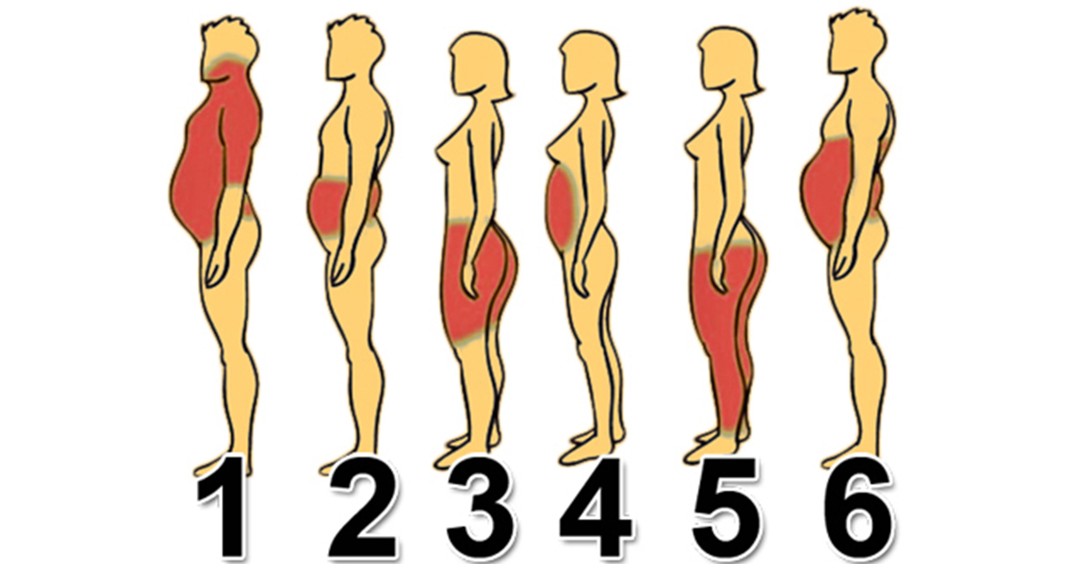 6 Типов Ожирения: Как побороть любой из Них