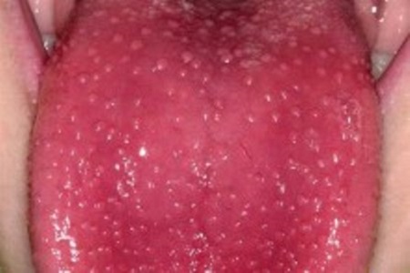 Язык — зеркало организма Язык — зеркало организма