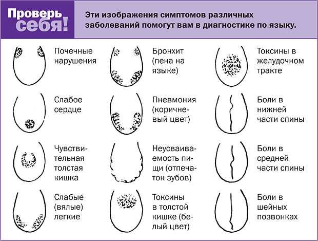 Язык — зеркало организма Язык — зеркало организма