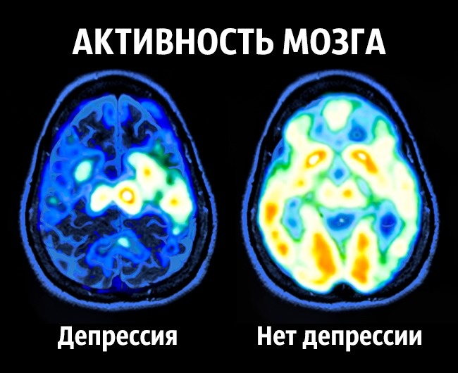 Советы нейробиолога о том, как стать счастливым раз и навсегда Как стать счастливым