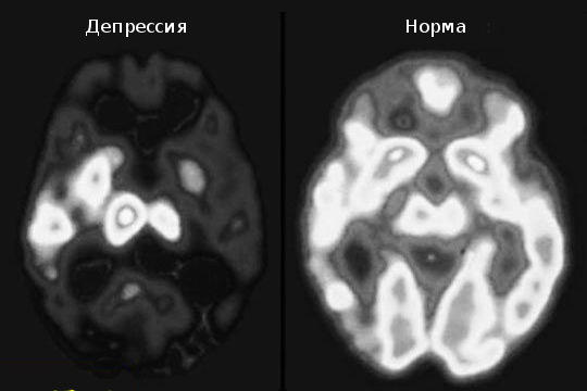 Что переживает Душа, Тело делает видимым